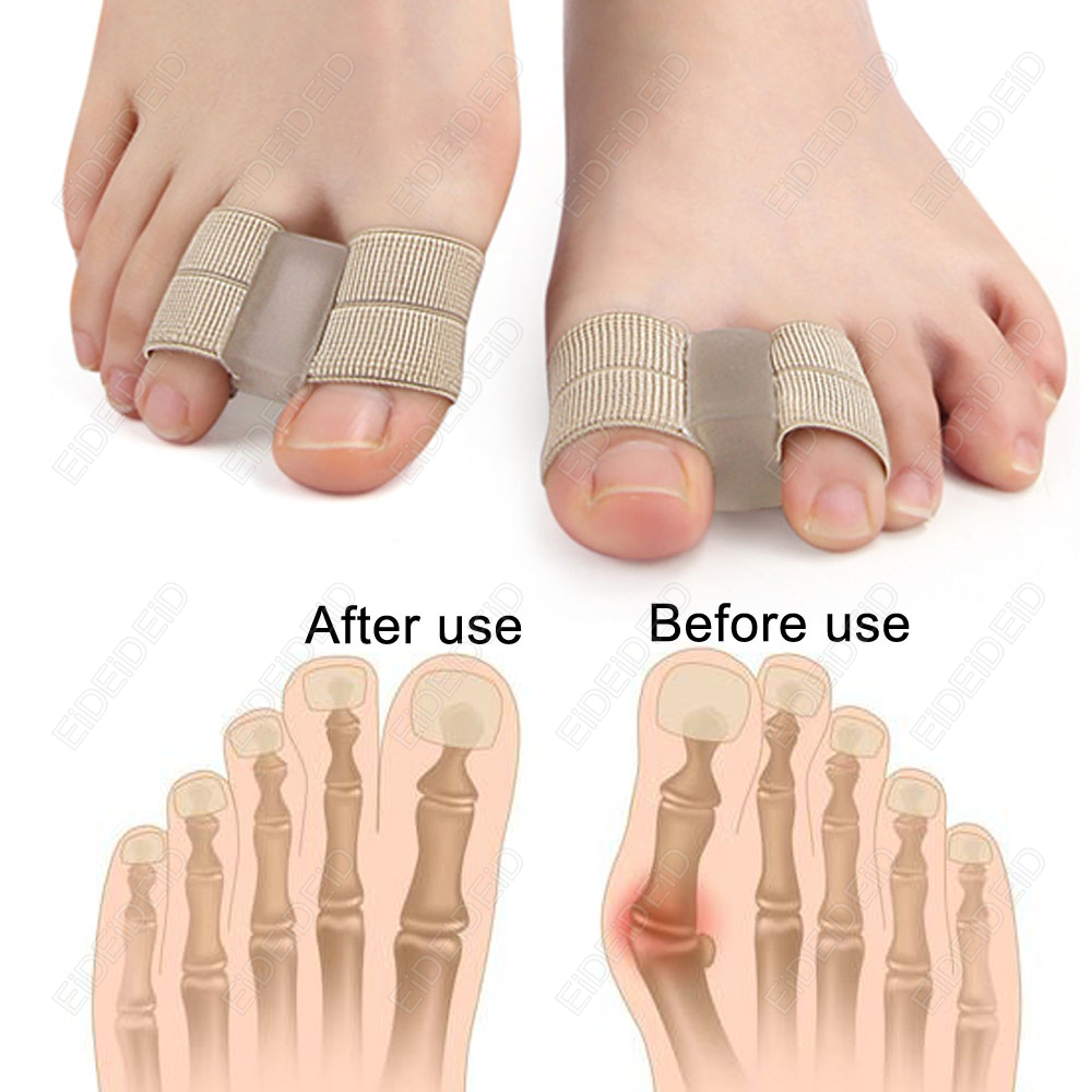 Korektor na haluksy Orteza na  – Women'S Shoes With Bunions recenzja i cena